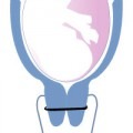 le cerclage du col de l'utérus