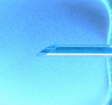 fécondation in vitro - fiv